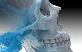 CT_Skull001 copy